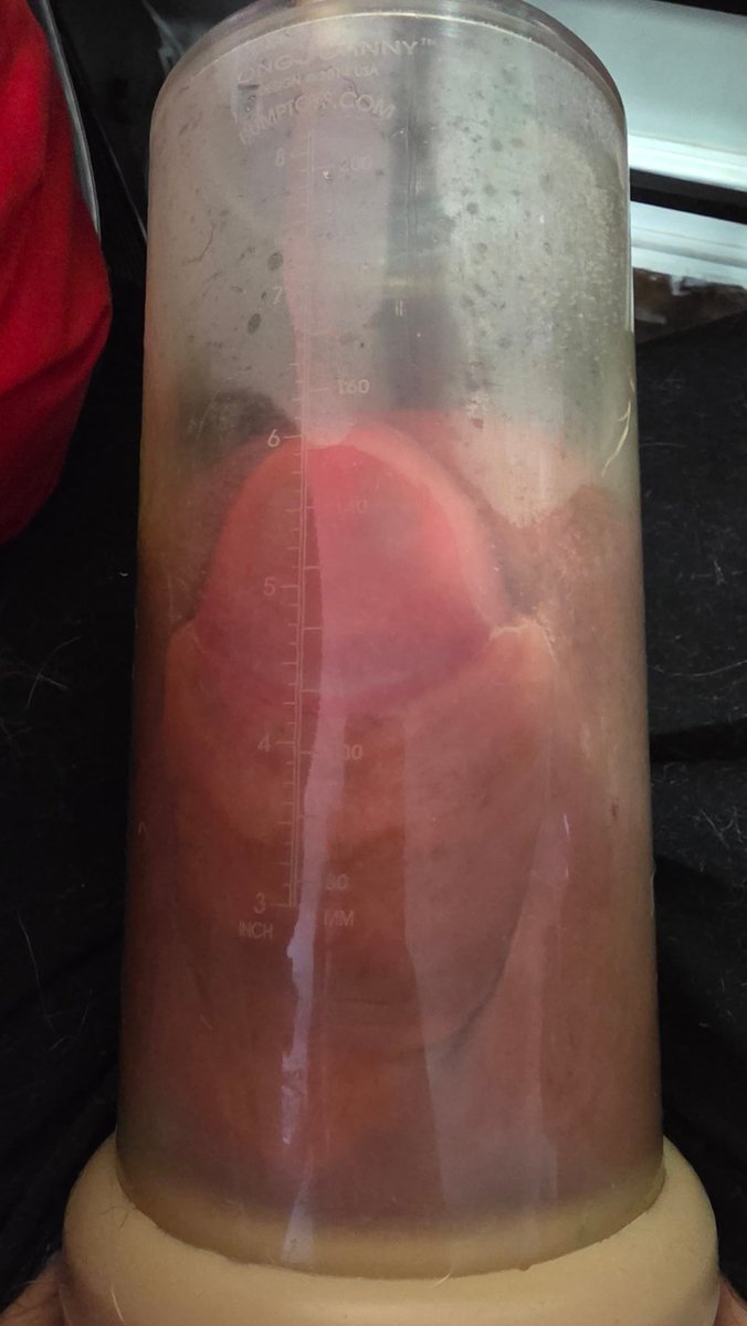 It's not Jey unless the balls touch tweet media