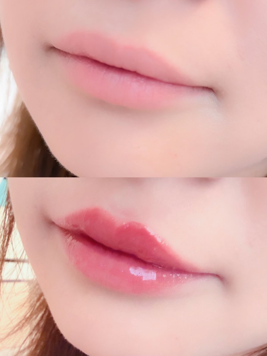 mochiii_77's tweet photo. LoNLyのキャンドルライトジュレティントCL04とフレイムライトリッププランパーFF01の組み合わせ最強すぎる♡プランパーは効果が高くてビリビリするけどぷっくりM字リップ作れるよ！ビタミンC成分が入ってるから皮向け対策にも◎プランパーは下地としてもティントの上からグロスとしても使えるよ！ #pr https://t.co/DwkfkVDkXR
