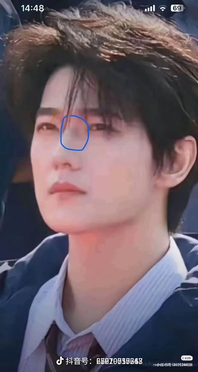Imfangirl17's tweet photo. People are blaming YY fans for this!! You People just need an excuse to hate YY . Before he got so  much hate for no reason he only do one drama per year . He work very hard for every single role he is injured so badly this time People still blaming him:( https://t.co/iiby12UBnN