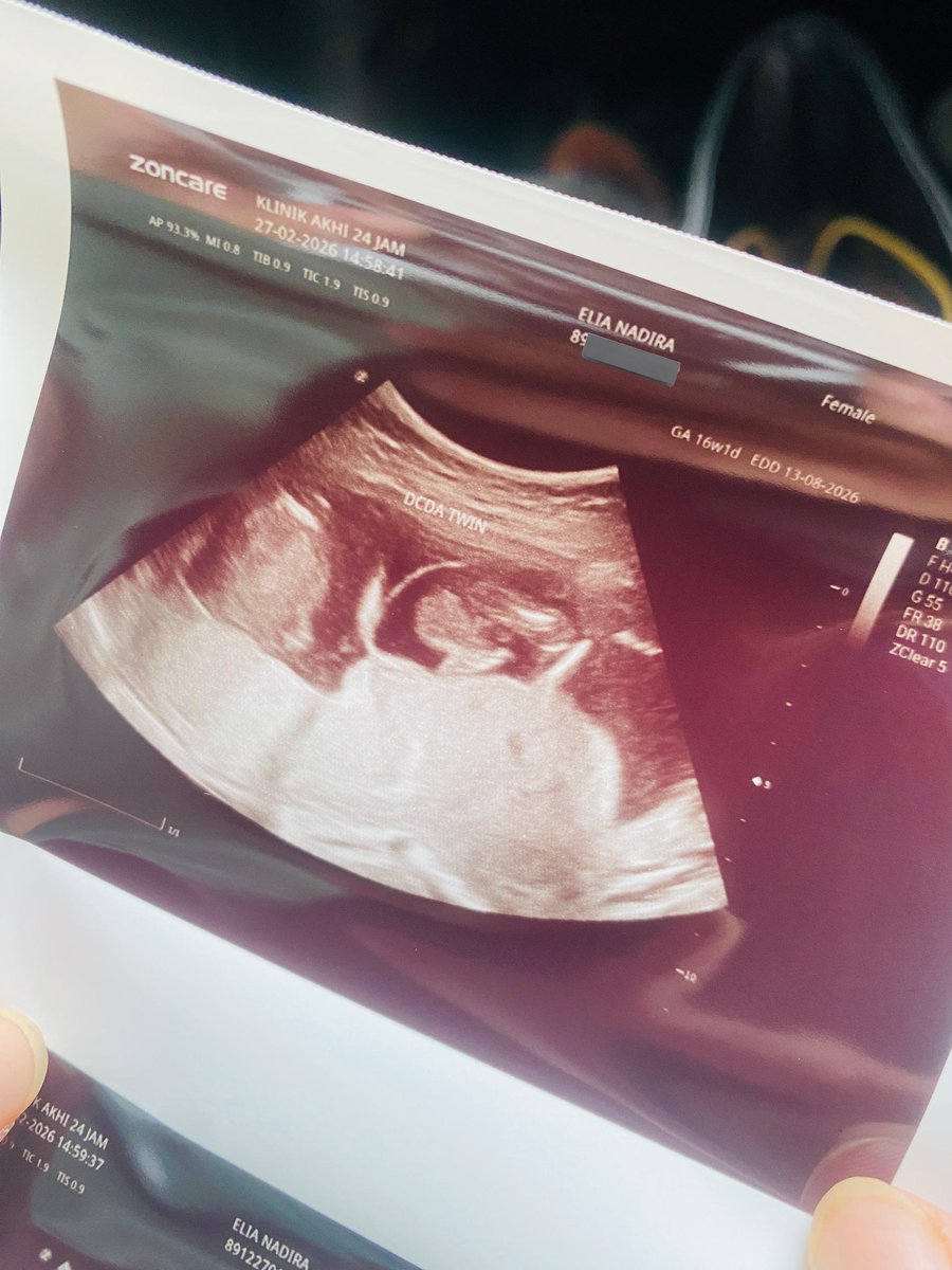ellyyantz's tweet photo. Assalamulaikum anak mama daddy 👶🏻👶🏻 https://t.co/2r627ToKRS