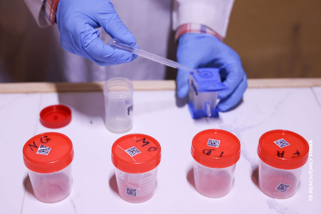 Stop TB Partnership tweet media