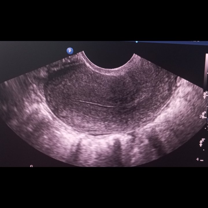Beauty ☢️😎

#radiology #ultrasound