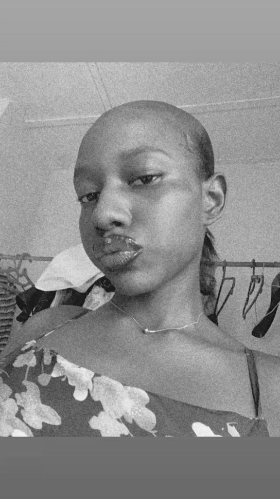 This you btw forehead like agege bread