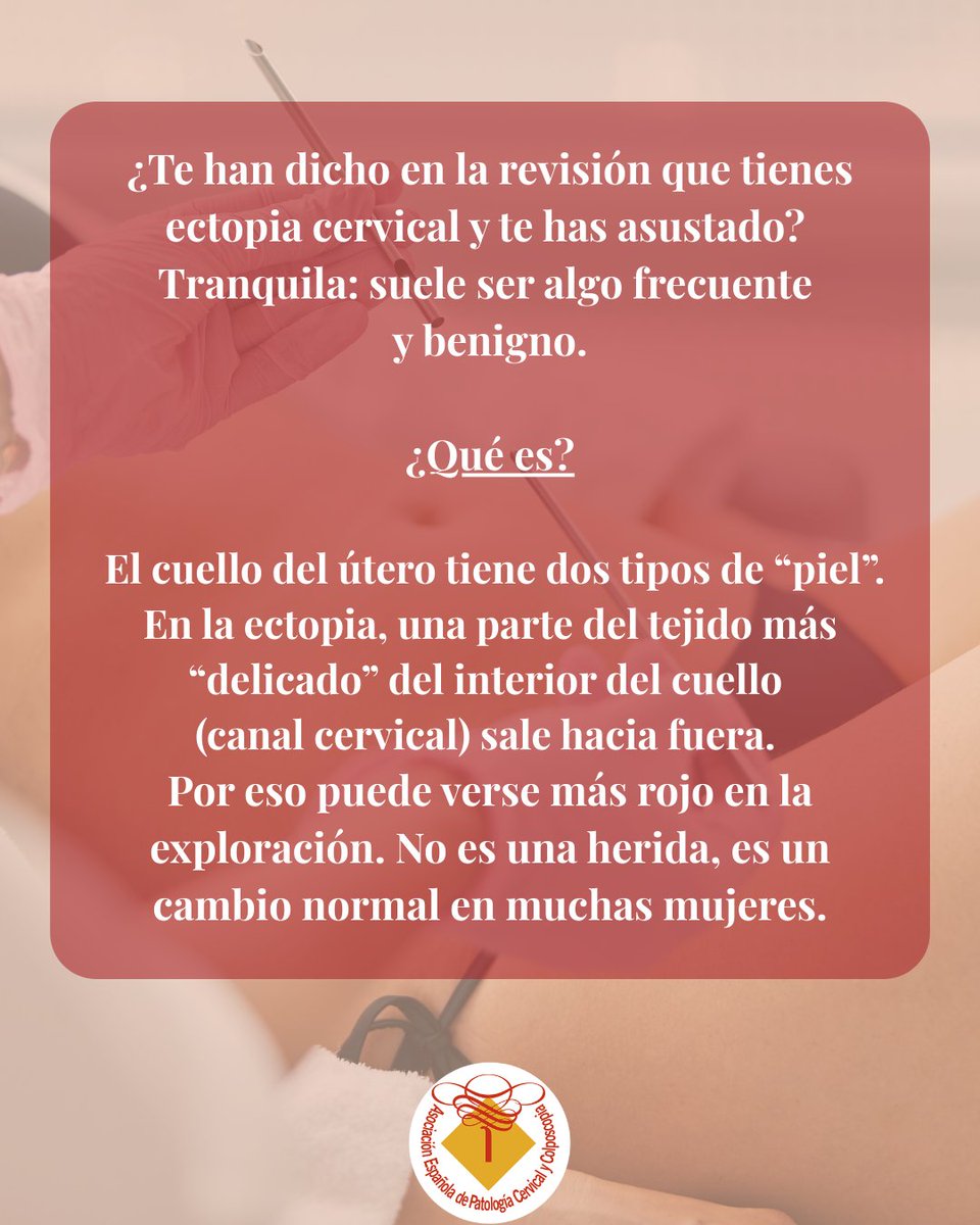 aepccolposcopia's tweet photo. 🔍 Ectopia cervical: ¿qué es y cuándo preocuparse?
Es más frecuente de lo que parece y suele generar muchas dudas.
Te contamos todo lo que necesitas saber 👇
#AEPCC #Ectopia #Prevención https://t.co/awbAmaGSG0