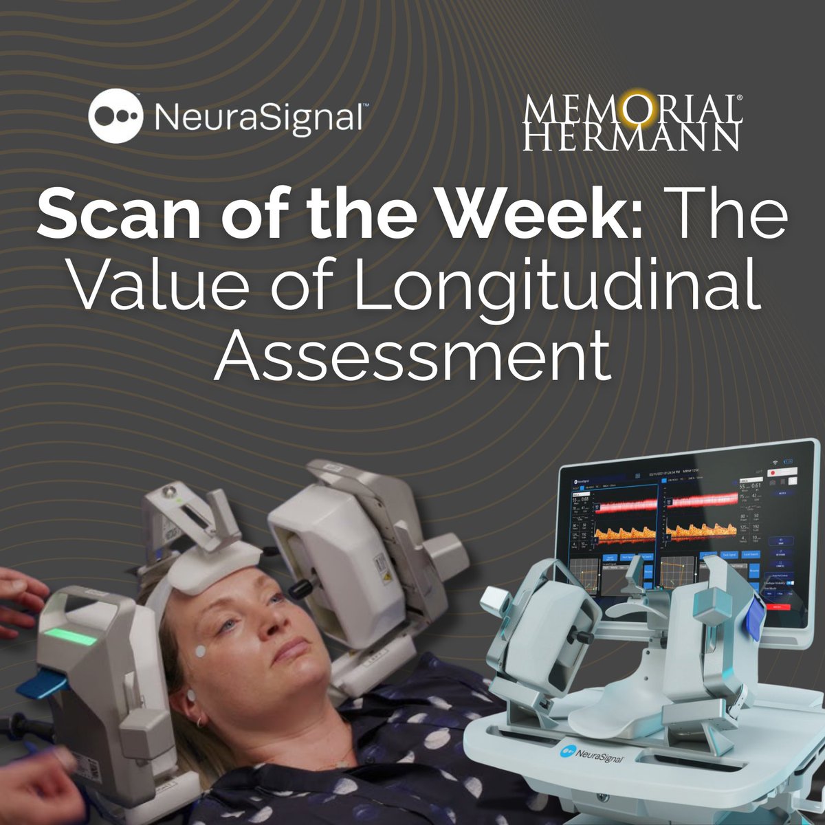 NeuraSignal tweet media