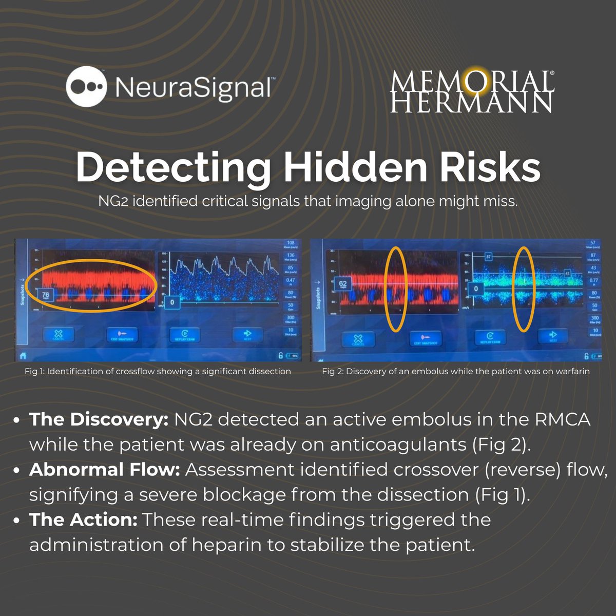 NeuraSignal tweet media