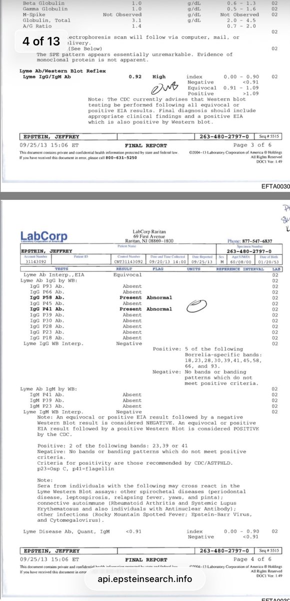 TruthCuresLyme's tweet image. Epstein’s 2013 Lyme test. The Lyme mafia would call that “negative” but we know better. Also, it’s kinda looking like the Lyme mafia is part of the larger worldwide pedo-money laundering-9/11ing mafia.