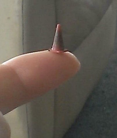 porqueTTarg's tweet photo. "Cono"

Porque un hombre que creía tener cáncer de pulmón se sometió a una cirugía urgente para extirparle un tumor canceroso. 

Los cirujanos descubrieron que no tenía cáncer de pulmón; el tumor era en realidad un cono de tráfico de juguete que inhaló hace 40 años. https://t.co/HwWsmw84yQ