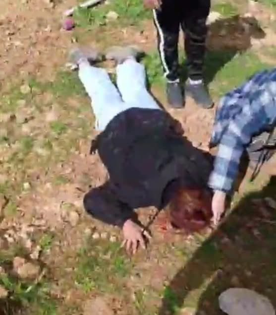 עדי כהן, אישה כל כך חמודה שמעולם לא פגעה באיש, קיבלה היום נבוט בראש ופונתה במסוק לבי״ח.
הייתי אומר שאני בהלם אבל לצערי זה היה רק עניין של זמן עד שיקרה לה משהו חמור.
לגבי היודונאצים שהתקיפו אותה - מאחל להם מוות בייסורים קשים. הלוואי והיה אלוהים שישלם להם.

שקט הוא רפש. אל תשתקו.