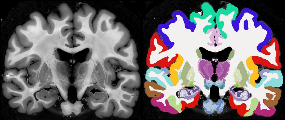 Juan Eugenio Iglesias tweet media