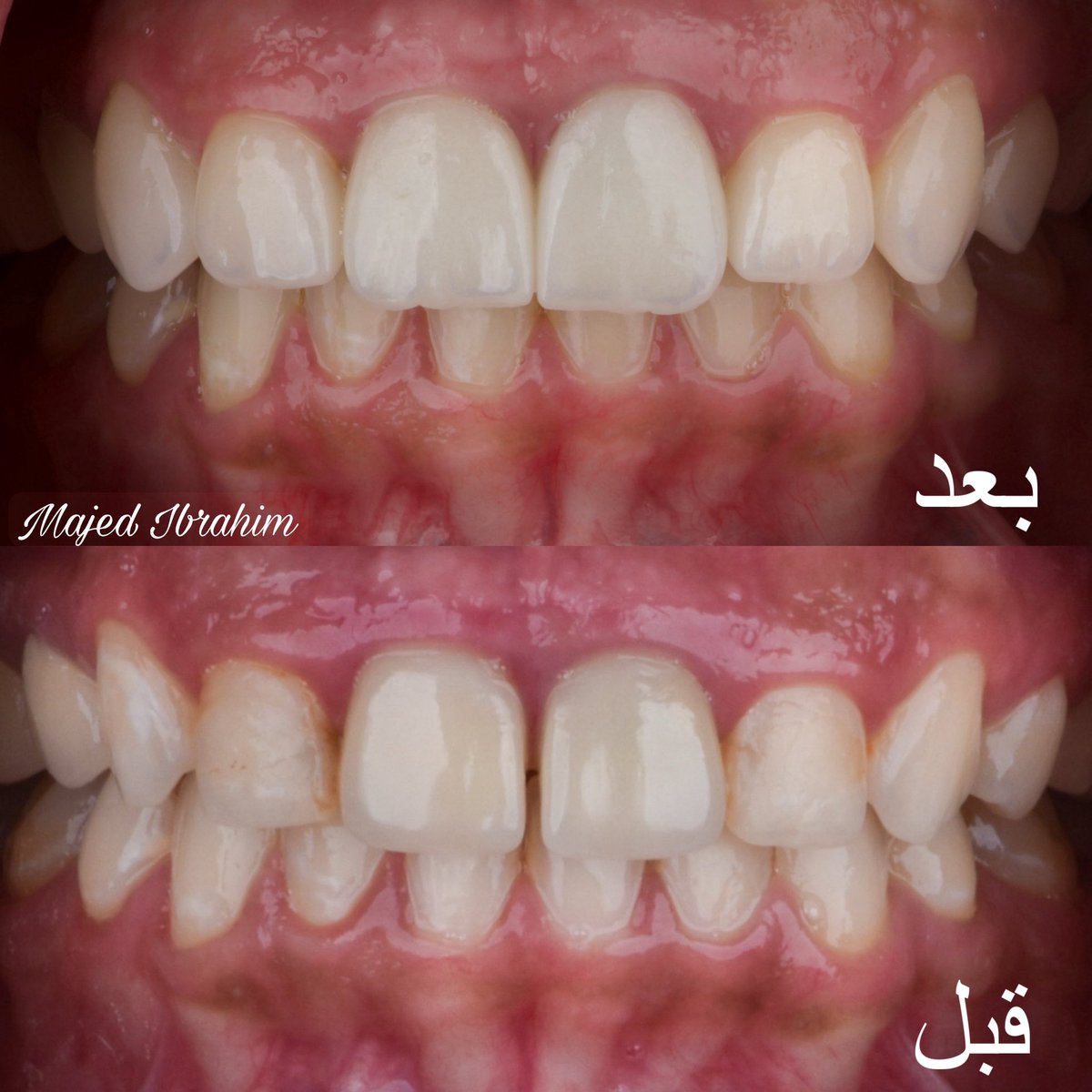 Majed_Dent's tweet photo. https://t.co/RrpOEbaU6Y