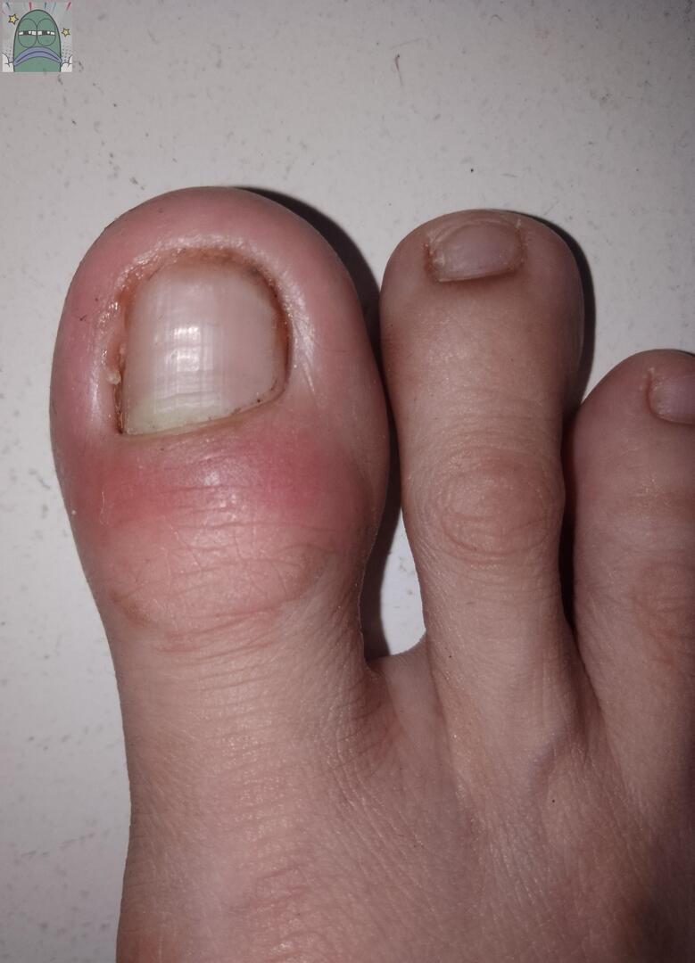 Tanyarlfes tweet media