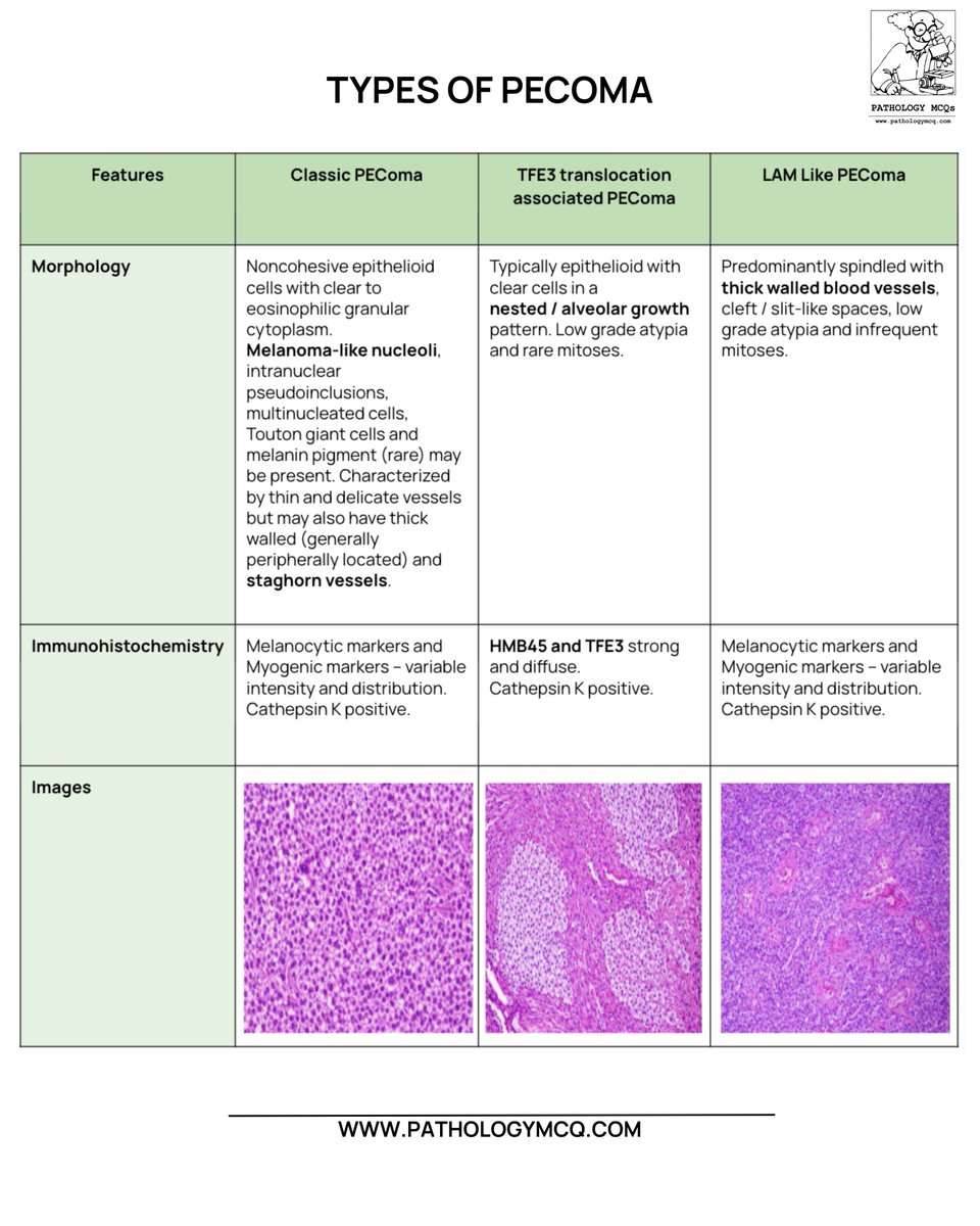 🔬 PEComa is a spectrum, not a single entity.

🧬 Classic → Clear epithelioid cells 
🧩 TFE3 → Nested/alveolar growth 
🩸 LAM-like → Spindled cells 
🎯 Pattern recognition makes the diagnosis.

#PEComa #SoftTissuePathology #HighYieldPathology #TumorPathology #Oncopathology