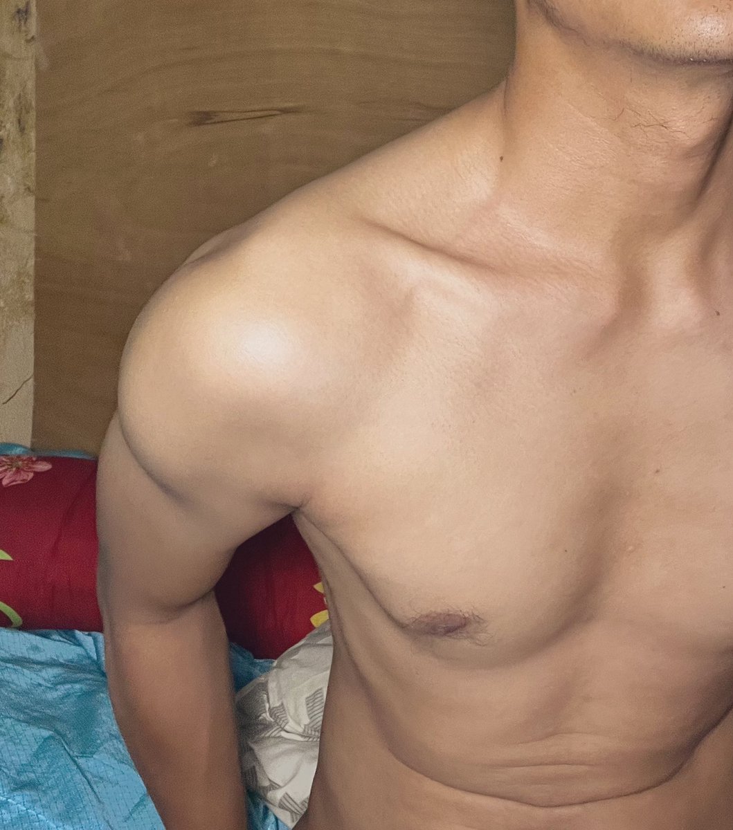 Suka Insecure tweet media