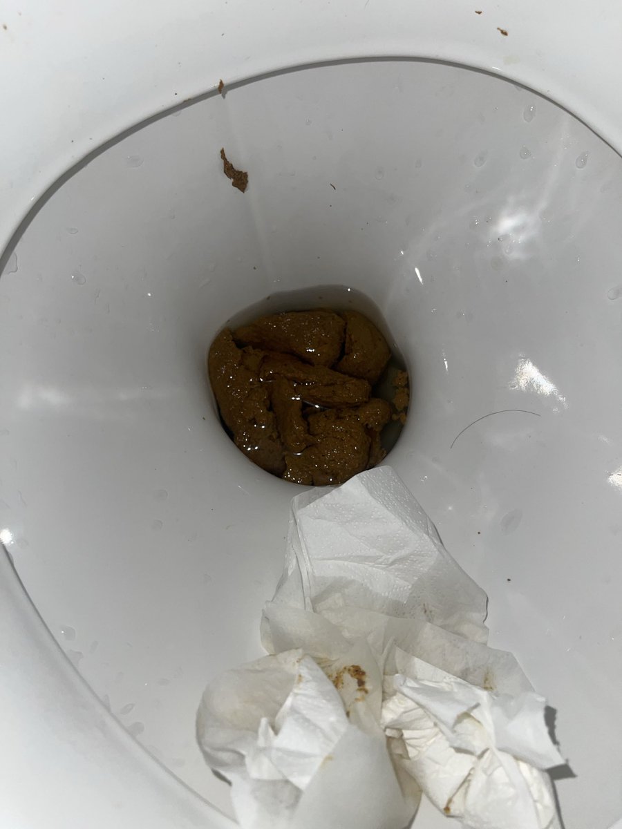 MikeTurd12's tweet photo. Big Turd 💩 dump this morning. How was yours ? #scat #poop #menshit #bigturd https://t.co/6HrMesKwzg