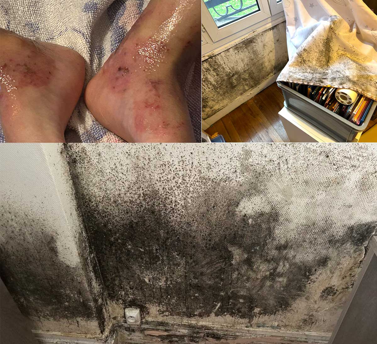 🔴 Logement social insalubre : infiltrations, humidité, moisissures. 
Mère seule, 4 enfants dont une fillette allergique de 6 ans, y vivent.
Relogement d’urgence demandé à la <a href="/_RIVP_/">RIVP</a>
0 réponse. Une pétition est lancée.

Ça, c’est l’enfer <a href="/David_Belliard/">David Belliard</a> 

change.org/p/urgence-loge…
