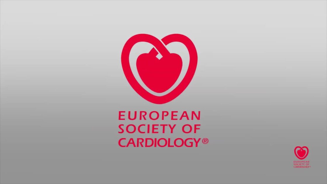 europawire's tweet image. Study Published in Cardiovascular Research Demonstrates Health Effects of Short-Term Traffic Noise Exposure news.europawire.eu/european-resea…

@escardio @WHO_Europe #nighttime #road_traffic #noise #heart #bloodvessel #cardiovascular #healthcare #wellness #partnership