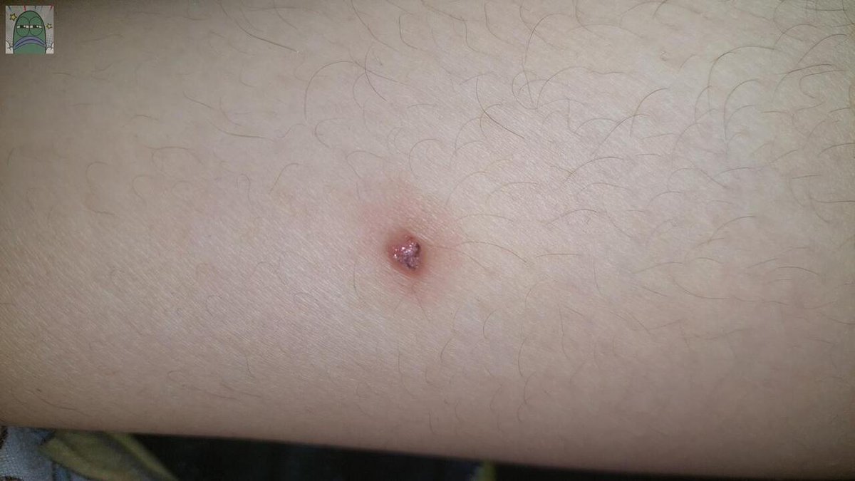 Tanyarlfes tweet media