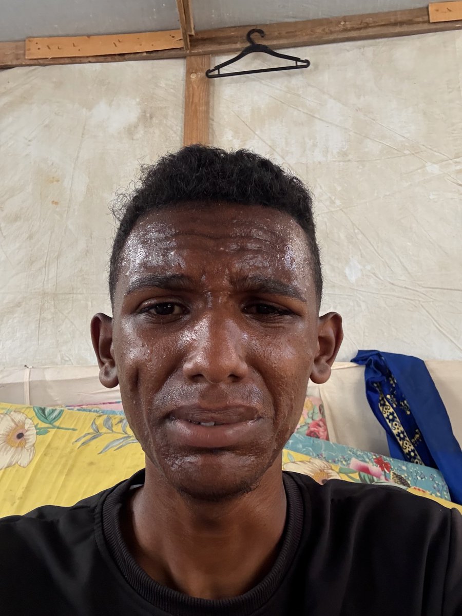 I will not forgive anyone who sees this post and does not support me with a single word and ignores me.
If you see this, leave even a dot

chuffed.org/project/168480…