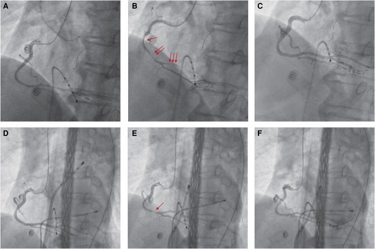 European Society of Cardiology Journals tweet media