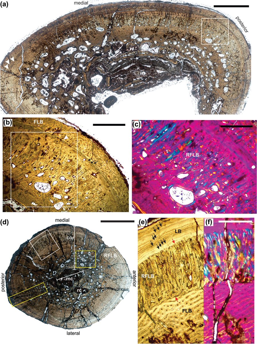 AnatRecord's tweet photo. First evidence of an epidemic in Late Triassic phytosaur community: Colossosuchus techniensis show aggressive periosteal “sunburst” bone growth &amp; resorption. Likely bacterial osteomyelitis suppressed immunity &amp; led to demise. 
Sarkar &amp; Ray: https://t.co/VTxHFCfoZM
#FossilFriday https://t.co/keRaFTzDPw