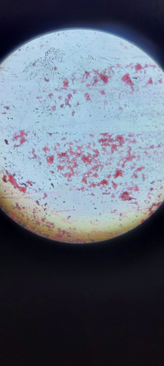 USABestPick52's tweet photo. What looks like tiny red dots could be billions of living cells working, dividing, surviving.
Science is pure magic — just real. 
#Biotech #MicroscopeView #STEM https://t.co/czlEBXr1Mk