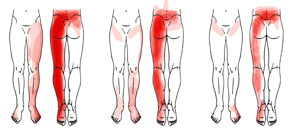 Thomas Dekkers | Spinal Specialist Physiotherapist tweet media