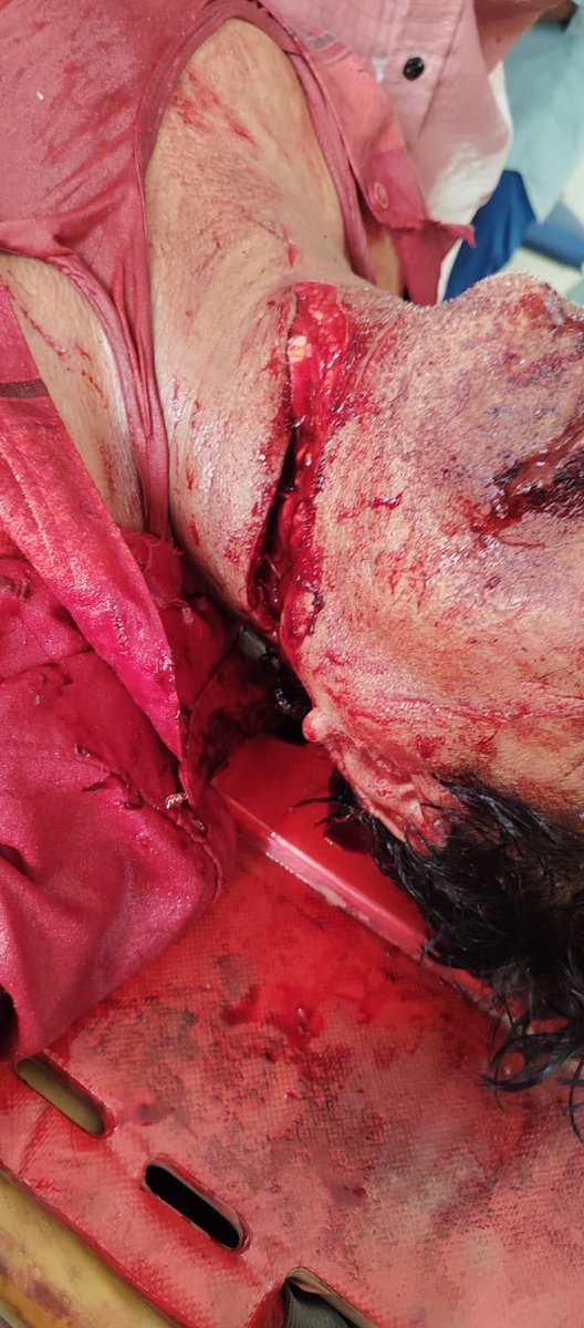 Sahil Wastik has been hacked by Jihadis. He left Islam to call out the barbaric cult. The barbaric cult hacked him to prove they’re not what he says they are. Mohammad Zubair dog-whistled against him several times. 

No. I won’t blur this image. Look at it. Don’t look away