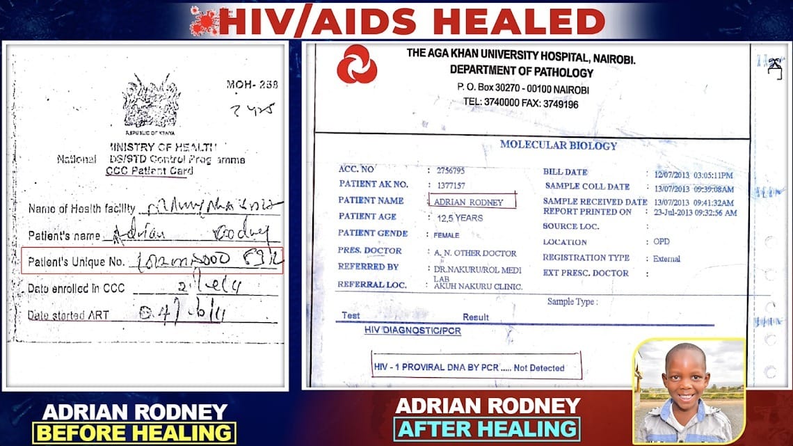 FredrickNe13291's tweet photo. #HIVBowsToTheLordJesus And It's Verified By The Doctors As Shown The Case Of 
-Jeniffer Odhiambo 
-Rodney Adrian &amp;
-Rebecca Mose https://t.co/thobI61q7Z