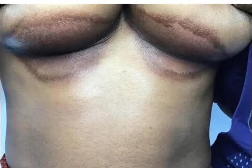 How can I get rid of this ???