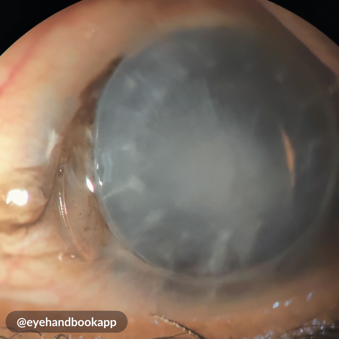 Eye Handbook tweet media