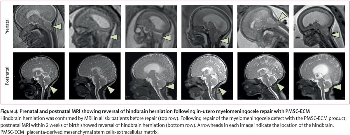 Samuel Hume tweet media