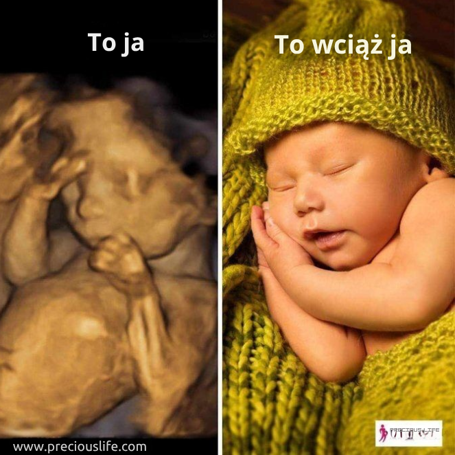 CitizenGO_PL's tweet image. #ProLife