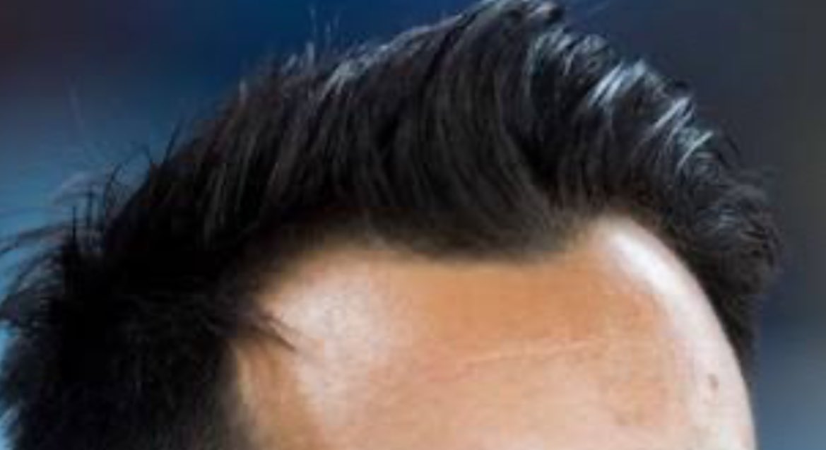 Do Not Scratch Your Eyes Watford FC Podcast 🐝 tweet media