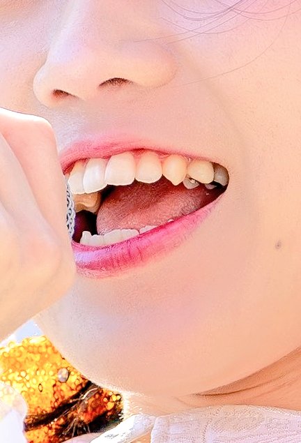 Tooth___fetish's tweet photo. 🤔🤔🤔🤔 https://t.co/rgMMd49Wvu