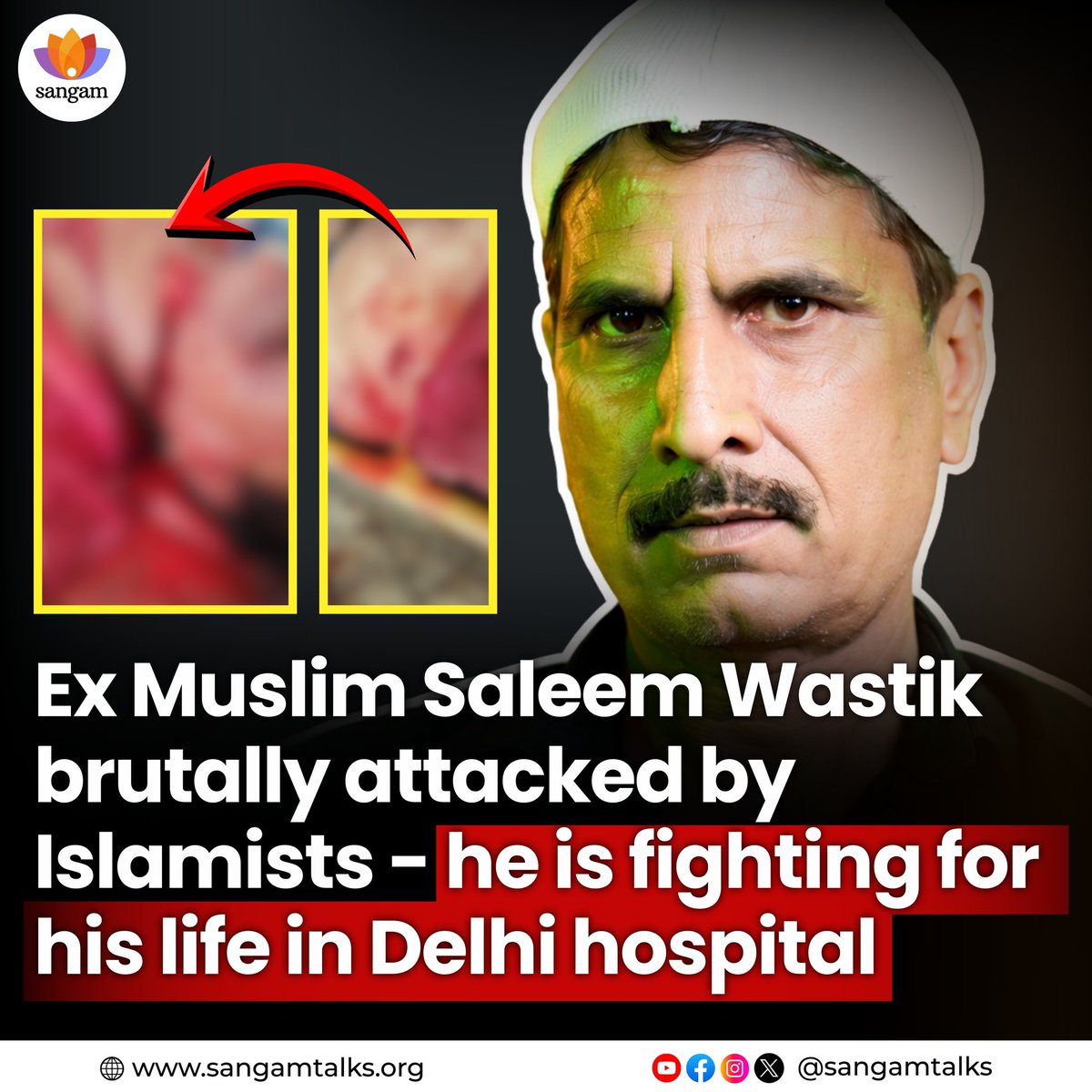 Aadhya_Dubeyy's tweet photo. Ex MUSLIM SALIM WASTIK NEWS 🚨🚨🚨 
Few X handles reports that ex muslim salim wastik is declared dead by doctors !!!
-
The government and law needs to teach these jihadis a lesson this time.
Only arrest won't serve justice..!!!
#ExmuslimSaleemWastik #exmuslimmovement #ExMuslim #Islam