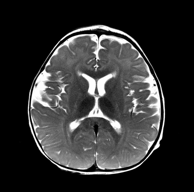 SPIN | Society of Pediatric Neuroimaging tweet media