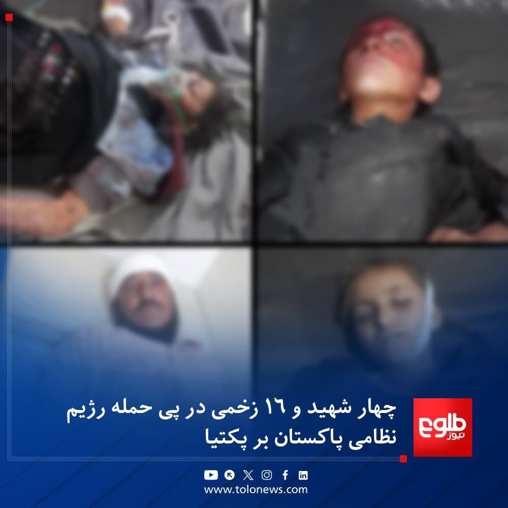 Today’s retaliatory attacks, which targeted Islamabad and nearby military bases, have dealt a serious blow to Pakistan’s morale and exposed clear failures in its defense systems, bringing them under strong scrutiny by both politicians and the public. Despite these setbacks,