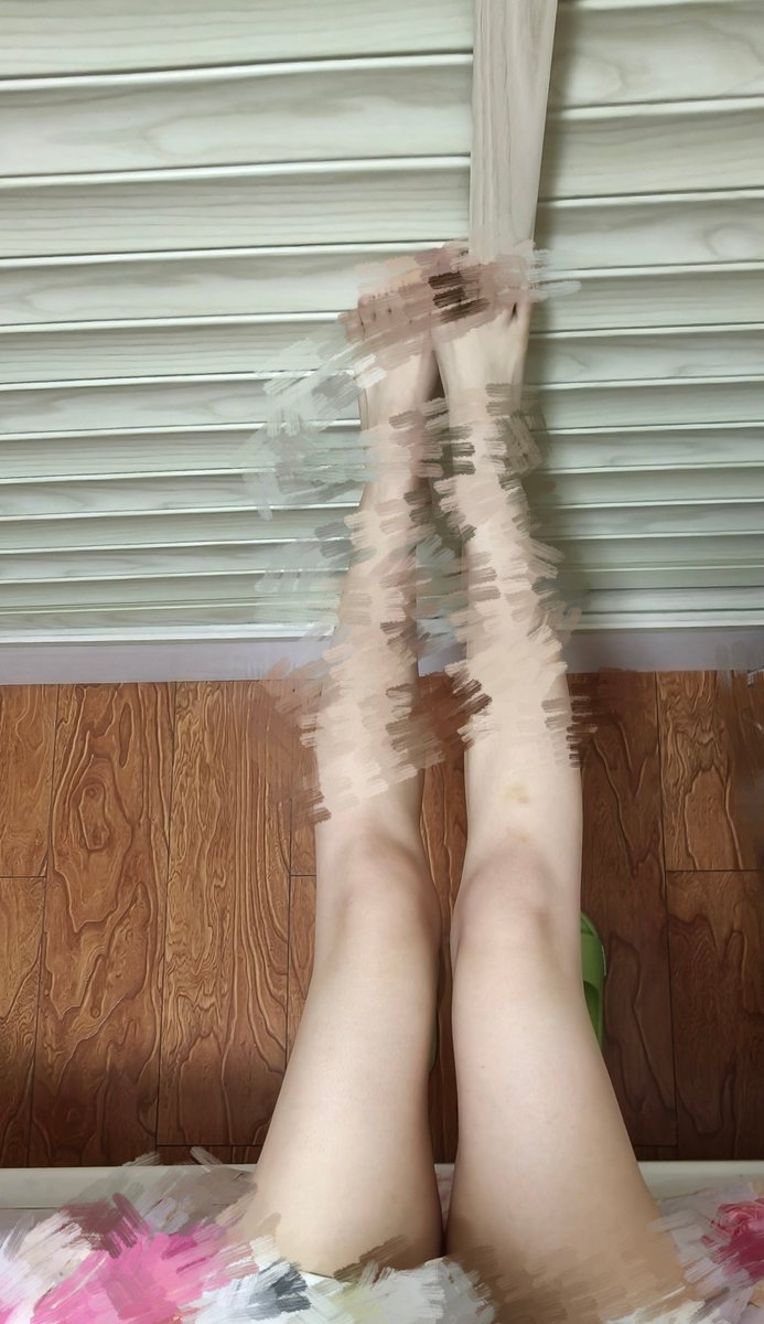 dusese1's tweet photo. 膝盖附近一年大概＞75％的时间都是有颜色的 这是什么注意力缺陷？一不小心就撞到东西😓 https://t.co/tl2y8zAJxq
