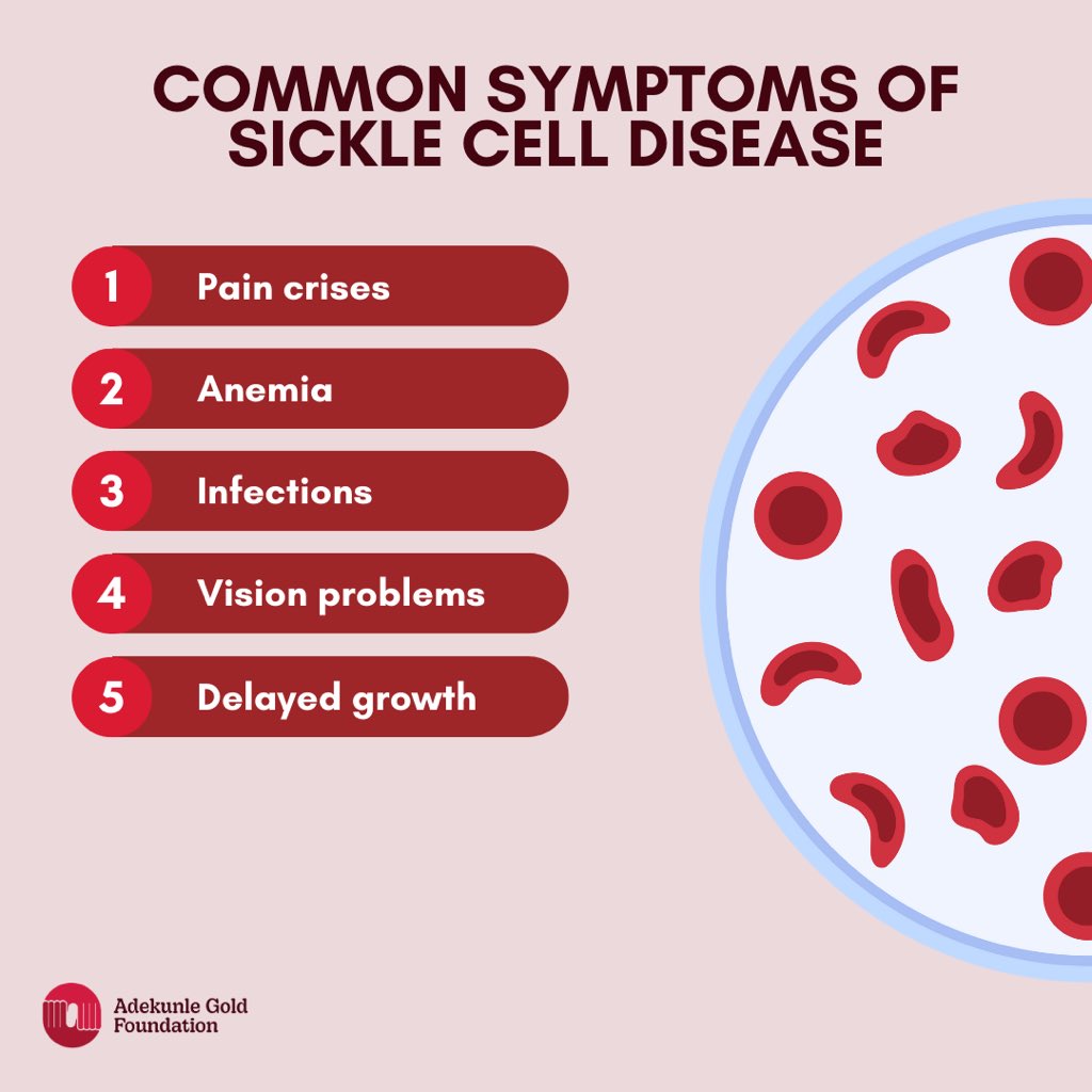 AGoldFoundation's tweet image. Get tested!
Get informed!!
Protect yourself and the next generation!!!

#AdekunleGoldFoundation 
#GenotypeTest
#GenotypeMatters #SickleCellAwareness