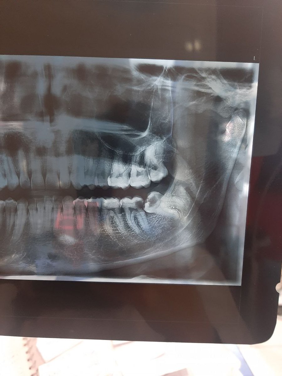 دندانپزشک سیّار tweet media