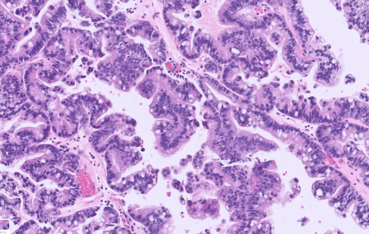 Peter Kobalka tweet media