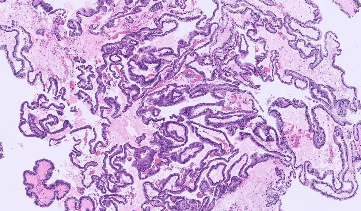 Peter Kobalka tweet media