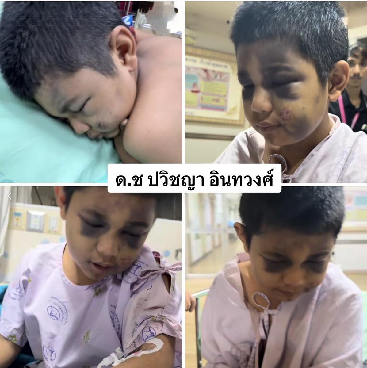 อห แม่เลี้ยงก็เหี้ย พ่อแท้ๆก็เหี้ยค่ะ

- น้องโดนรถชนแล้วอยุ่ที่โรงพยาบาล
- มีการประกาศ ตามหาญาติ แต่ไม่เจอ 
- เมื่อทราบว่าคุณพ่อน้องยังอยู่ จึงได้ติดต่อให้มาที่โรงพยาบาลเพราะต้องการญาติ 
- แต่คำตอบที่ได้คือ มาไม่ได้ เพราะลำบากมาก
- ทางกู้ภัยฯไม่รอ