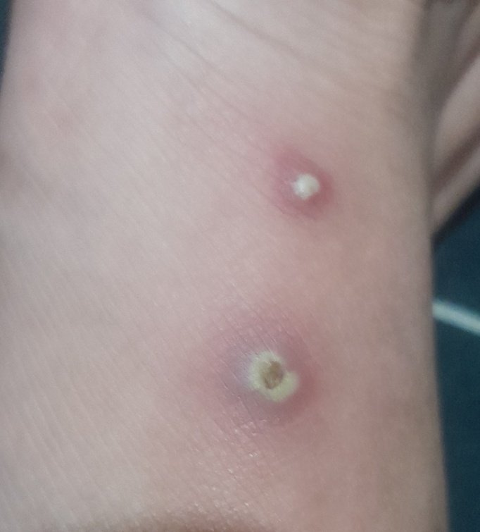 Keyies :U tweet media