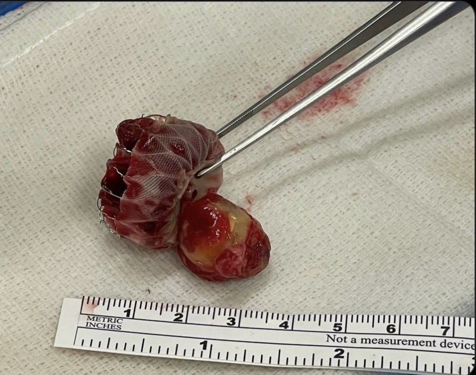 Ahmed Teebi, MD MPH MSc(Ox)🗝️ tweet media