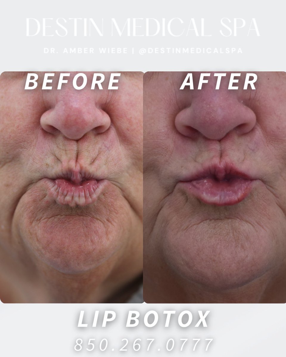 Destin Medical Spa (@Destin_Botox) / Posts / X