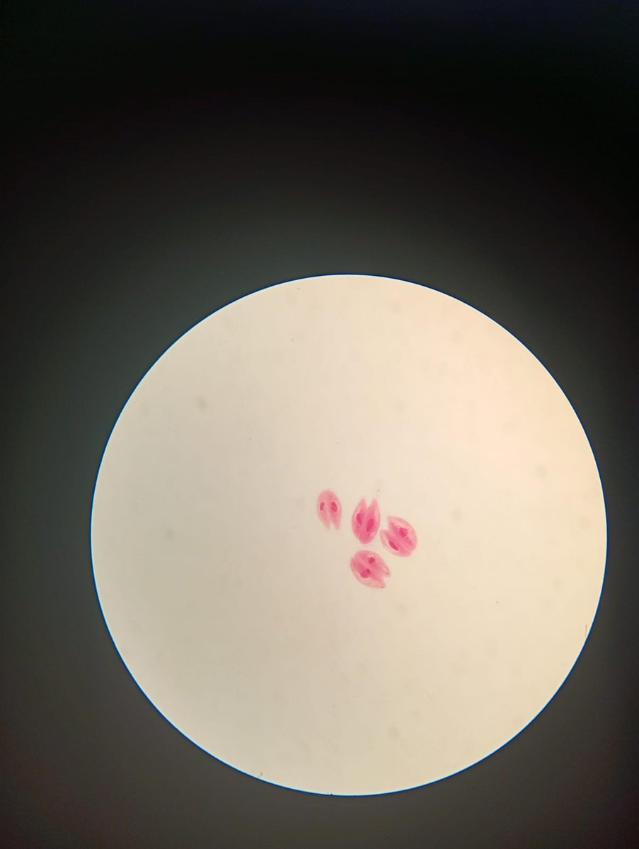 in dec i was looking at the fungus under a microscope and took a picture for microbiological analysis and some son of a bitch came up to me and said, "this looks like the stray cat from jjba manga," and it really does😭😭😭