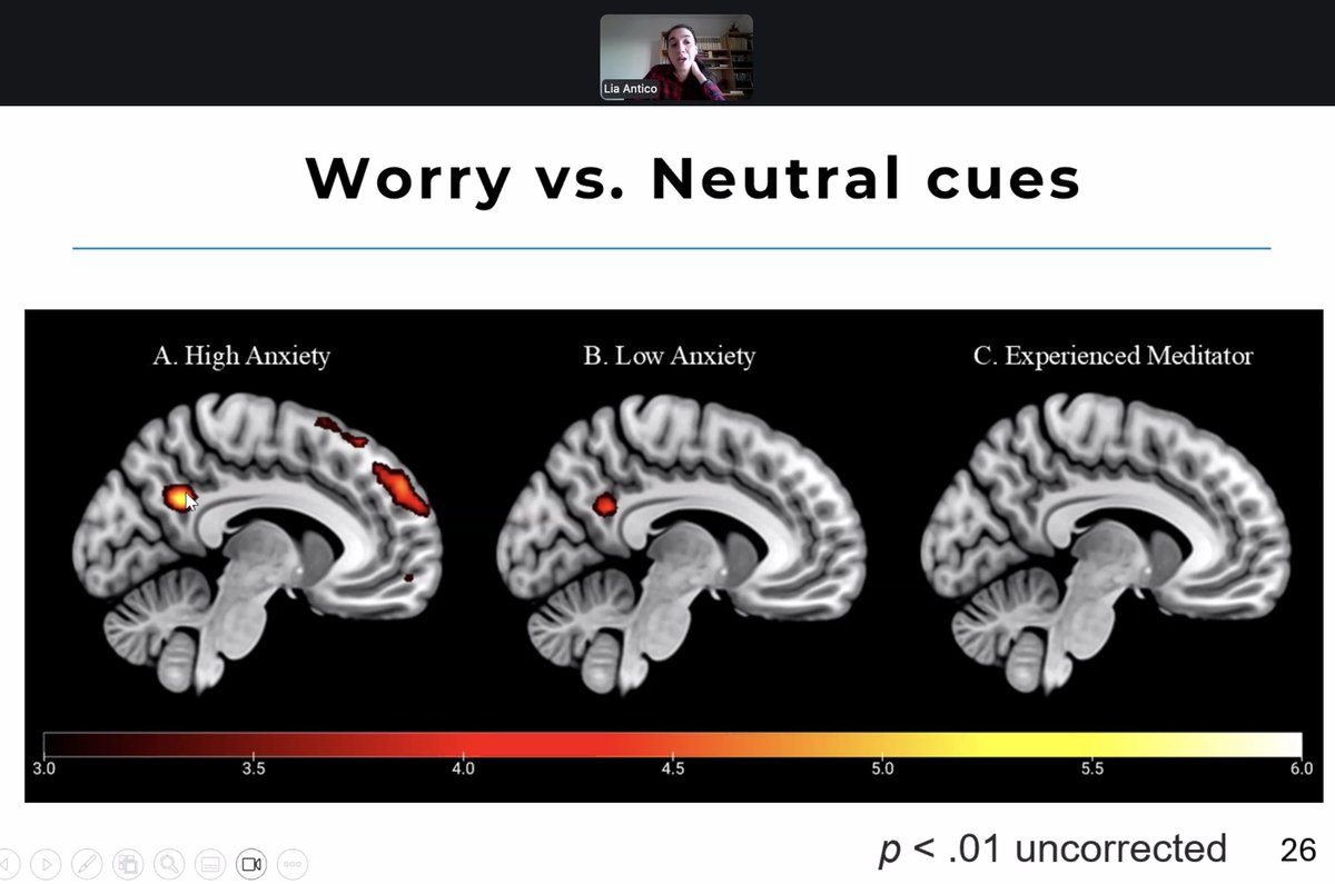 neuromichael's tweet photo. The bread and butter of contemplative-to-clinical science: meditation to reduce anxiety! Practical intro DIY course at https://t.co/MCOW2L9ypy
#Meditation #MeditationForAnxiety #LovingKindness #ContemplativeScience #Neurospirituality https://t.co/I9kZPji1KD