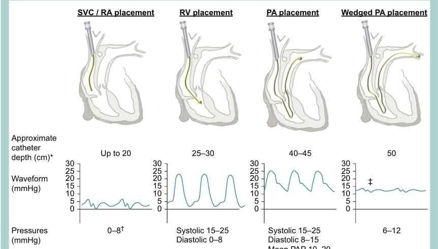 RECAT👩🏽⚕️🏥👨🏽⚕️🇲🇽🫀 tweet media